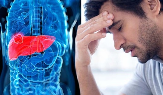 Men gan thấp nguy hiểm không? Người có dấu hiệu này cần cảnh giác