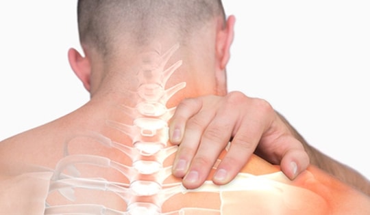 6 câu hỏi thường gặp về hội chứng đầu cổ