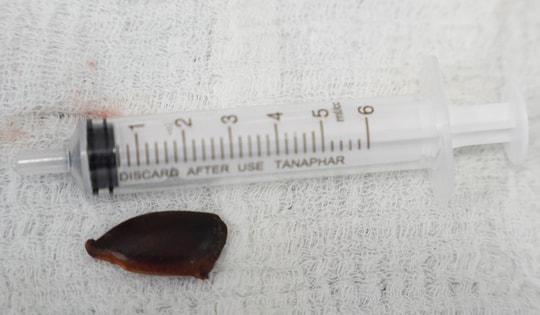 Ho kéo dài, cụ bà 75 tuổi ở Quảng Ninh vào viện mới phát hạt
hồng xiêm trong phế quản