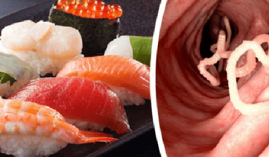 Tránh xa các thực phẩm sau nếu không muốn bị loét dạ dày và bệnh tim mạch