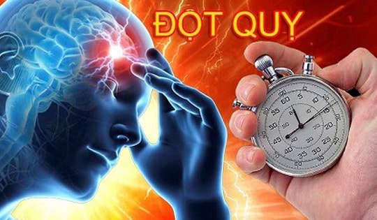 Người phụ nữ 65 tuổi ở Hà Nội bị đột quỵ thừa nhận một sai lầm mà rất nhiều người Việt mắc phải