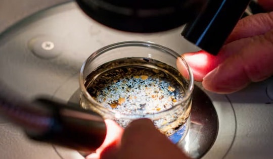 Lần đầu phát hiện vi nhựa trong dịch nang buồng trứng người