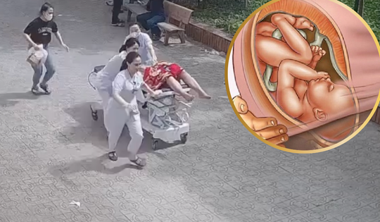 Sản phụ nguy kịch vì sa dây rốn, được cứu sống thần kỳ trong 5 phút