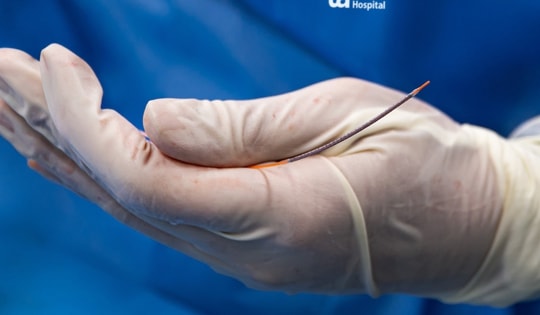 Stent phủ thuốc thế hệ mới giúp kéo dài tuổi thọ cho bệnh nhân tim mạch