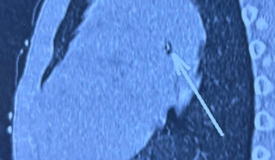 Bé trai 7 tuổi thở ra...tiếng kèn