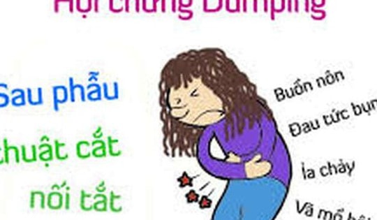 Điều trị Hội chứng Dumping dùng thuốc nào?