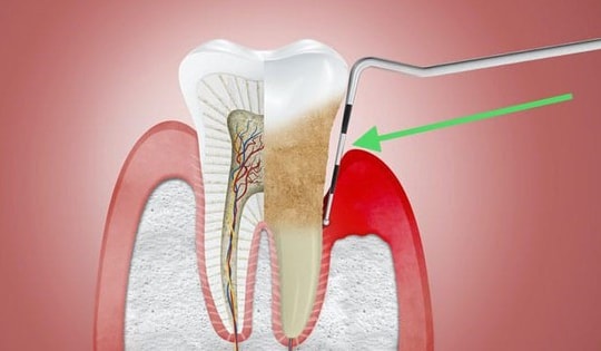 Nói không với thói quen xấu, bảo vệ sức khỏe răng miệng