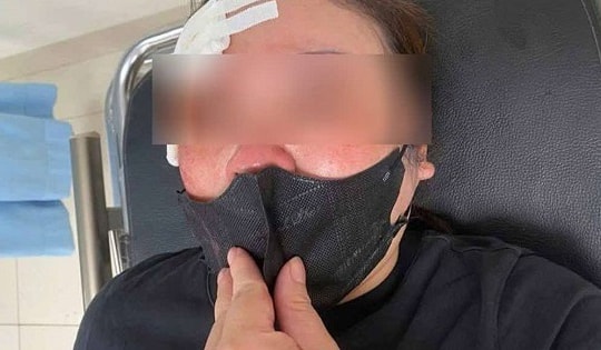 Xin tránh đường không được, người đàn ông đi ô tô dùng dùi cui vụt vào đầu một phụ nữ