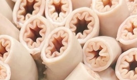 Chuyên gia: Con lợn nào có nhiều giun sán thì khả năng có lòng se điếu