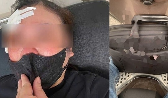 Một phụ nữ bị đánh giữa phố vì dừng xe nghe điện thoại