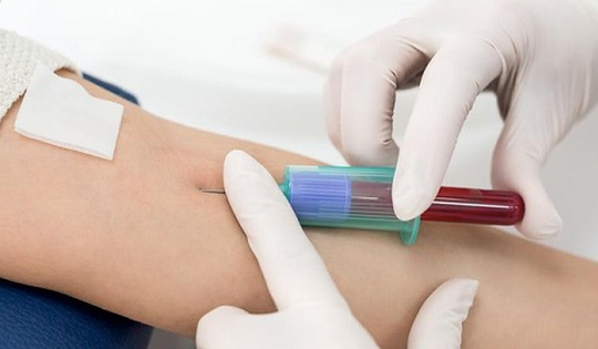 Người dân đổ xô xét nghiệm dấu ấn ung thư, chuyên gia nói gì?