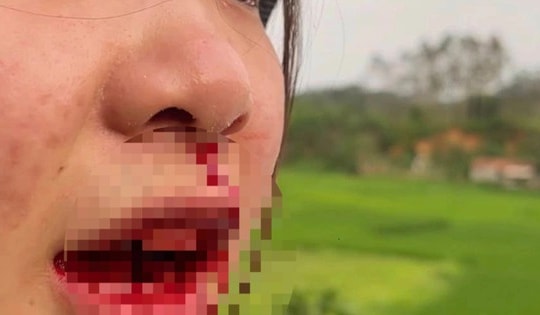 Đang xác minh vụ tài xế ô tô hành hung cô gái chảy máu mũi ở Bắc Giang