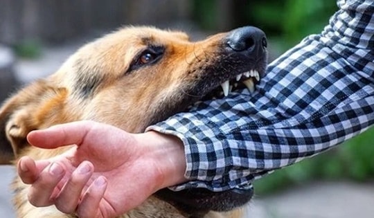 Bé trai 13 tuổi nguy kịch sau 2 tháng bị chó cắn vì việc làm này của người thân