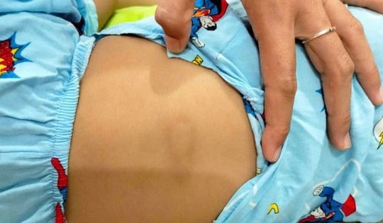 Bé gái ở Bình Thuận chấn thương ‘vùng kín’, nghi bị điểm giữ trẻ bạo hành
