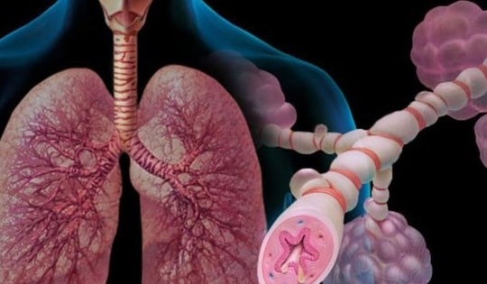 Khoảng 4 triệu người Việt mắc bệnh hen, gánh nặng bệnh tật không nhỏ