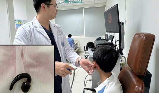 Tắm suối cùng anh trai, bé 3 tuổi bị đỉa 5cm chui vào khí quản