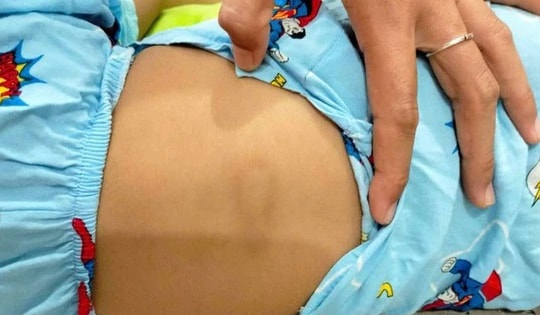 Đình chỉ cơ sở giữ trẻ sau vụ bé gái bị chấn thương 'vùng kín'