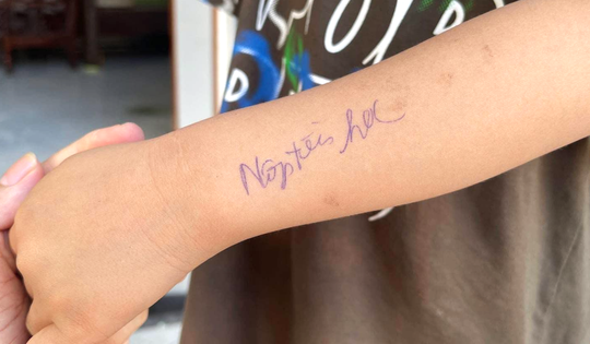 'Nộp tiền học' viết trên tay trẻ mầm non: Hành động sư phạm cần xem xét lại