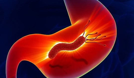 Người đàn ông phát hiện cùng lúc 5 bệnh từ dấu hiệu nhiều người Việt bỏ qua