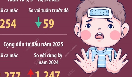 Hà Nội: 254 ca mắc tay chân miệng trong một tuần