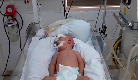 Cảnh báo trẻ mắc uốn ván do sinh tại nhà, tự cắt dây rốn