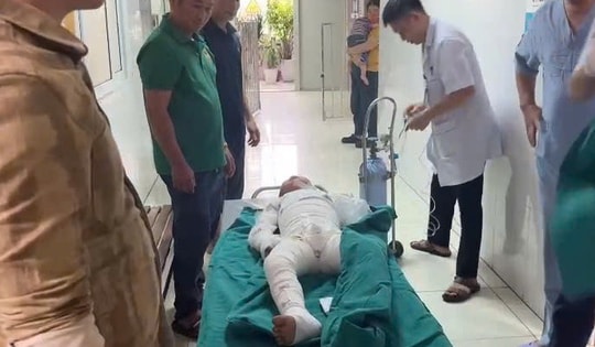 Dùng xăng để đốt kiến, hai anh em bỏng nặng