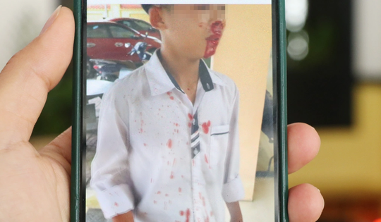 Người đàn ông đánh cậu bé hàng xóm chảy máu vì mâu thuẫn của con nhỏ