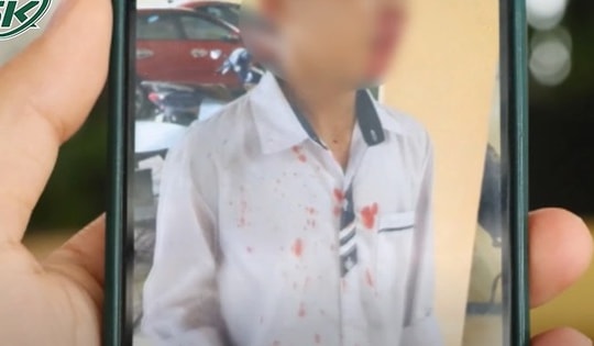 Phẫn nộ phụ huynh chặn đánh nam sinh lớp 7 tới đổ máu, lý do chỉ vì một lời mách của con