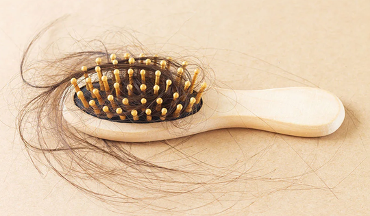 5 tác dụng phụ của minoxidil trị rụng tóc tại chỗ bạn nên biết