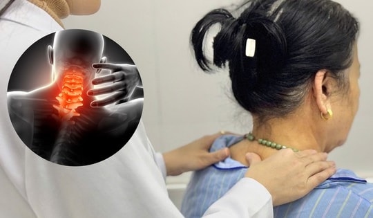 Tối ưu hóa hiệu quả điều trị thoát vị đĩa đệm đốt sống cổ bằng kết hợp Đông – Tây y