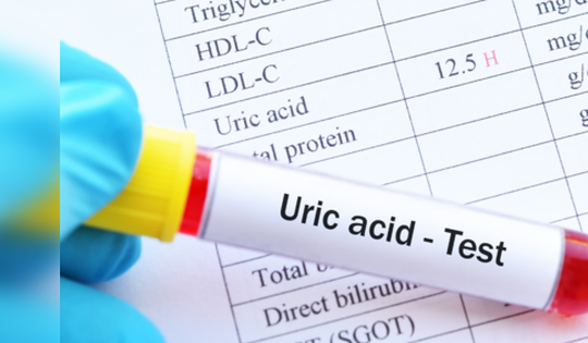 Người tăng axit uric cần tránh loại thực phẩm nào?