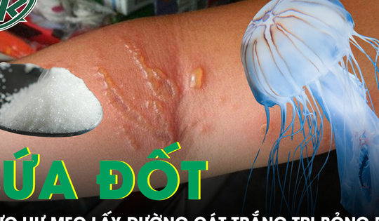 Thực hư mẹo lấy đường cát trắng chà vào vết thương sứa đốt sẽ hết bỏng rát