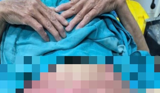 Tự điều trị viêm 'vùng kín', người phụ nữ ở Lạng Sơn bỏng nặng, lở loét toàn bộ vùng sinh dục