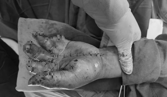 Người đàn ông nhập viện khẩn do thói quen dùng điện thoại nhiều người hay mắc phải