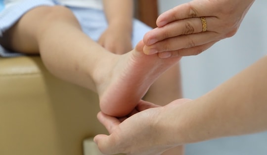 Sưng đau cổ chân phải sau khi chơi bóng rổ, tái phát nhiều lần, bé trai 11 tuổi được phát hiện có bàn chân bẹt hai bên