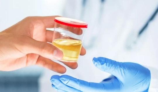 7 triệu chứng ban đầu của bệnh gan thường bị bỏ qua