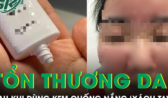 Nữ sinh bị tổn thương da nghiêm trọng sau khi dùng kem chống nắng SPF 70 ‘xách tay’