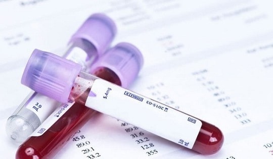 6 biểu hiện cảnh báo bệnh máu cần đi khám ngay