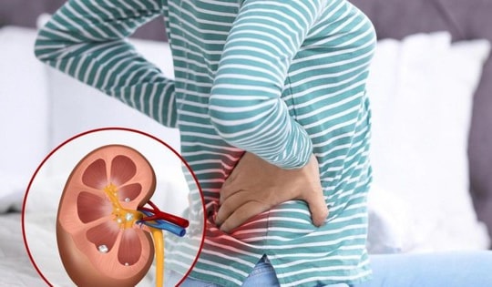 Dấu hiệu cảnh báo suy thận người Việt không nên bỏ qua