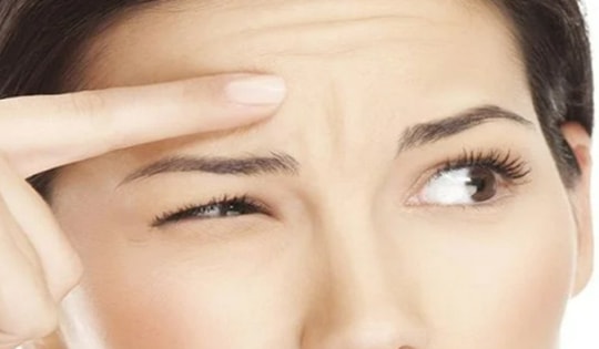 Nếp nhăn trán khi còn trẻ, làm sao để mờ dần?