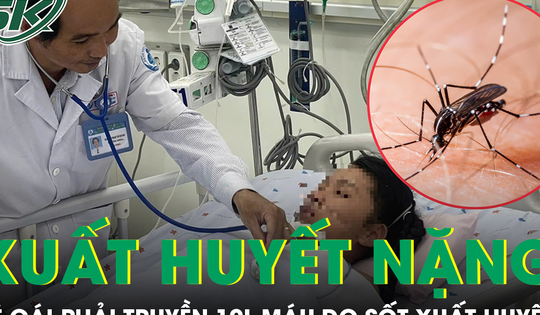 Sốc sốt xuất huyết, bé gái phải truyền 10 lít máu trong 24 giờ