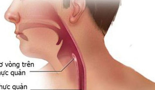 Người đàn ông 58 tuổi ở Quảng Ninh bị ung thư thực quản tái phát thừa nhận 1 sai lầm nhiều người Việt bỏ qua