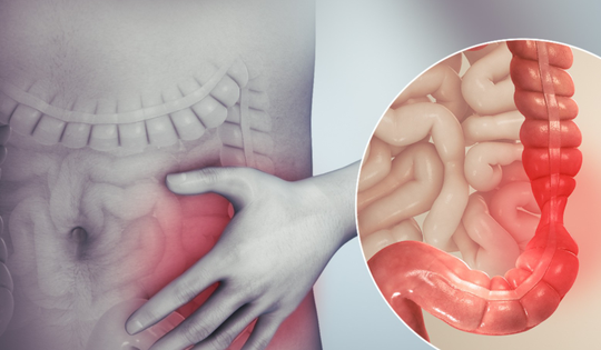 Người đàn ông 67 tuổi ở Hà Nội phát hiện ung thư đại tràng thừa nhận chủ quan với dấu hiệu báo bệnh này