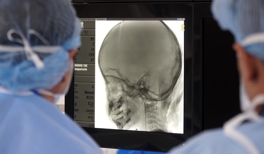 Bé gái 2 tuổi mắc u nguyên bào võng mạc may mắn được điều trị bảo tồn đôi mắt ngay 'phút 89'