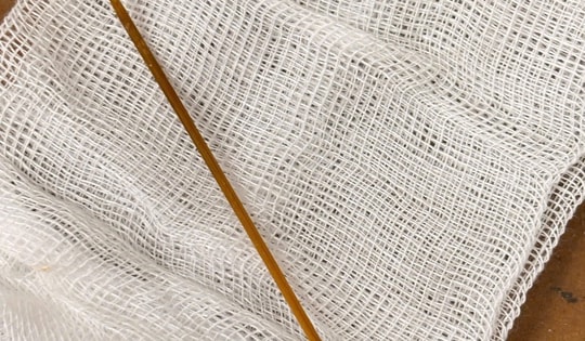 Nam thanh niên bị thủng manh tràng do nuốt phải tăm tre