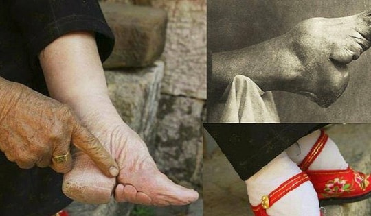 Cô gái 15 tuổi lấy chồng giàu nhờ "gót sen ba tấc" nhưng cái giá phải trả là thanh xuân bị bóp nghẹt đau đớn