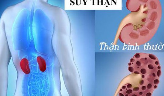 7 việc nên làm để phòng nguy cơ suy thận
