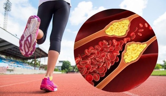 Cần đi bộ bao nhiêu để hạ cholesterol?