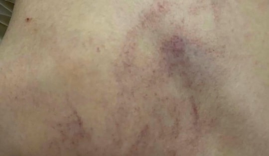 Sở GD&ĐT Hà Nội lên tiếng về nghi vấn giáo viên bạo hành trẻ tại Trường Mầm non Gia Thụy