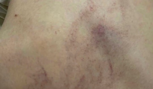 Vụ bạo hành trẻ ở Trường Mầm non Gia Thụy: 2 giáo viên bị tạm đình chỉ